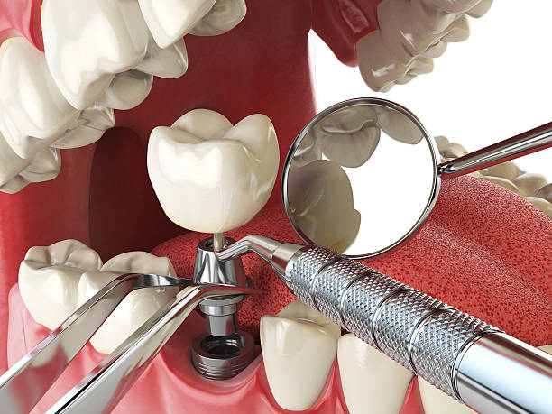 Best Emergency Gum Treatment in Calico Rock, AR