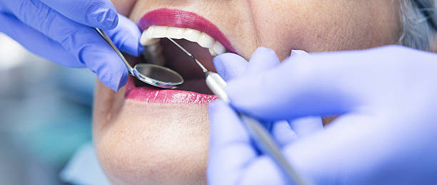 Best Emergency Tooth Extraction in Calico Rock, AR